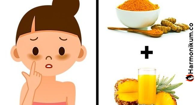 Pattanások, karikás szemek, leégés! A Nagyi tippjei mindenen segítettek! Ne felejtsük el a régi tudást!