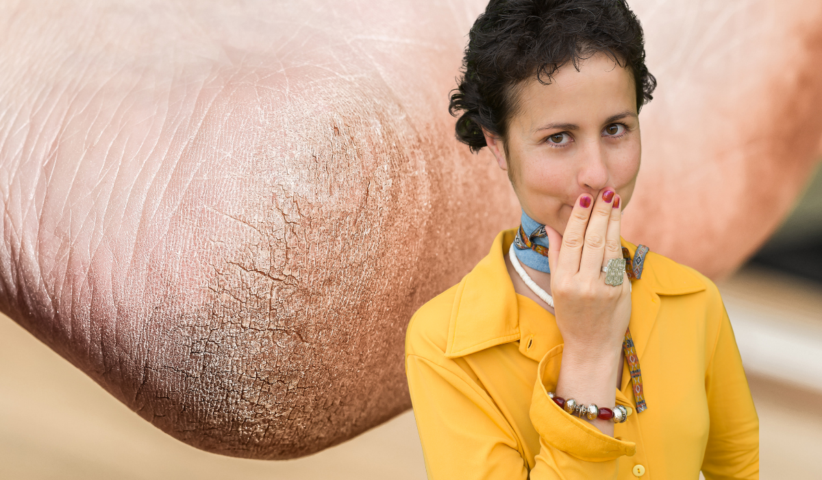 Az Alábbi Módszerekkel A Repedezett Bőr Már Csak Rémálmaidban Fog Megjelenni: