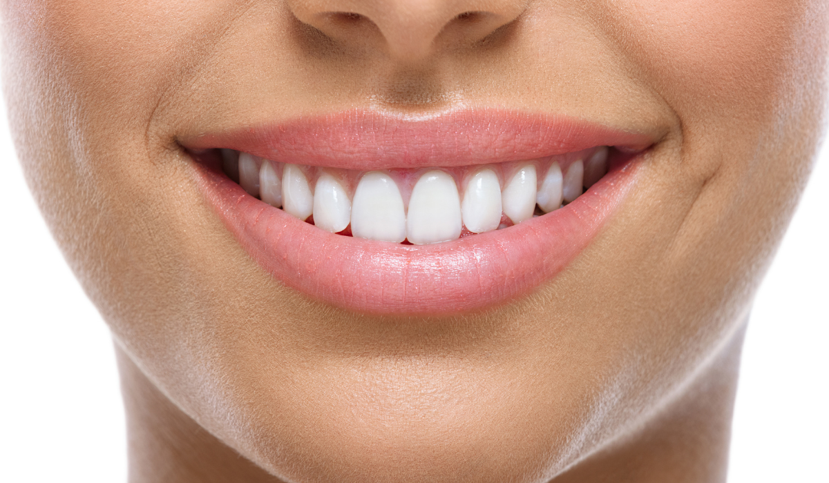 Így Lehet Pár Nap Alatt Vakítóan Fehér A Mosolyod: