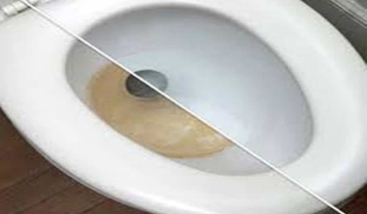 Varázsold Ragyogóan Fehérré a Sárga WC-t Ezzel az Egyszerű Trükkel!